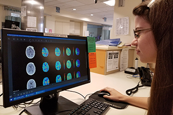 A BIDMC Vascular Neurology Fellow is reviewing a brain scan on the computer.