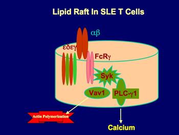 LR in SLE