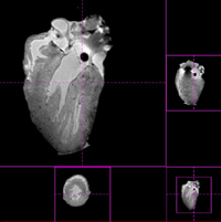 Isolated Organs: