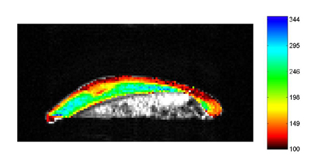 Calculated Parameter Images