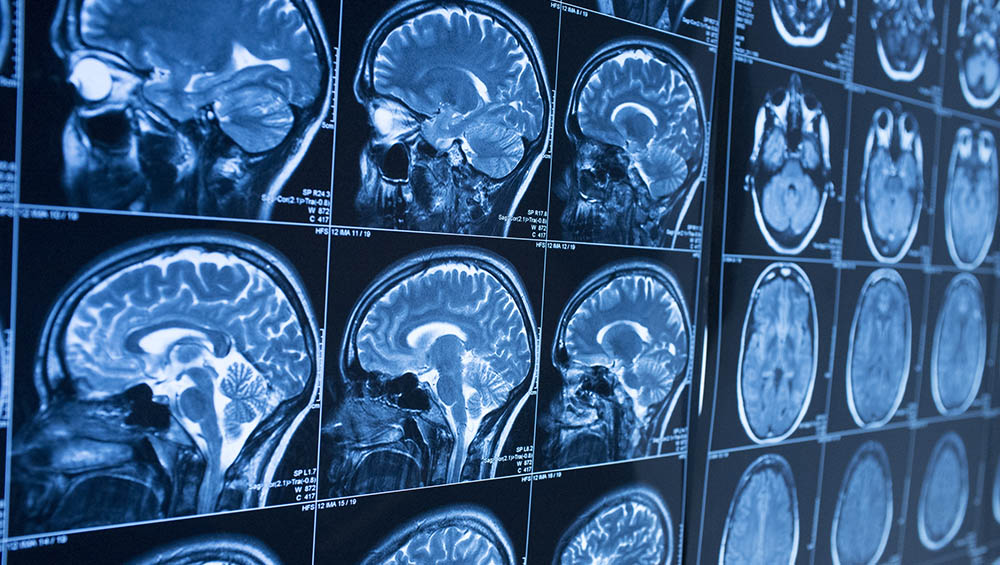 Brain scans of multiple angles and views