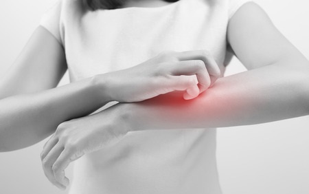 Progress on psoriasis, from 'last in line' to often first, but at a price (WBUR)
