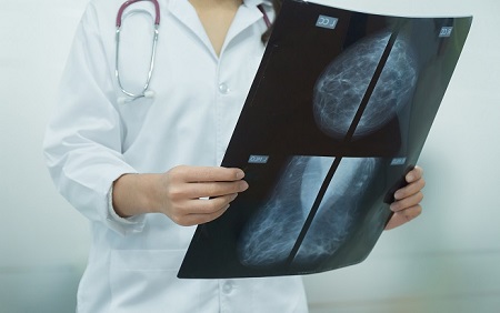 Procedure preventing dangerous complication for breast cancer survivors (WCVB)