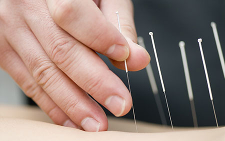 Acupuncture May Relieve Breast Cancer Treatment Side Effects