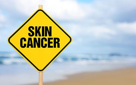 Skin cancer risks