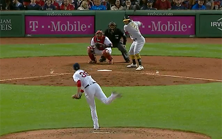 Understanding Subluxated and Dislocated Shoulder Injuries