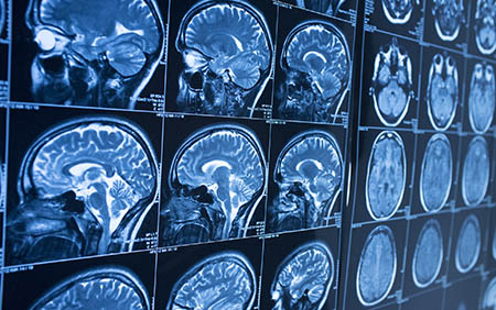Brain scans of multiple angles and views Brain scans of multiple angles and views