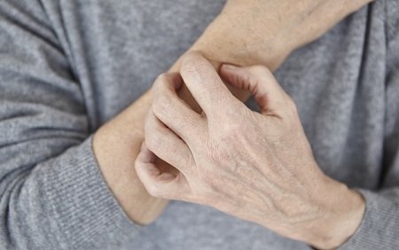 Study: Some Biologic Treatments for Psoriasis May Be Safer for Patients