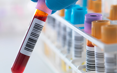 The Best Type of Exercise? A Blood Test Holds Clues