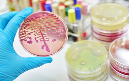 Research Points to Potential Shortcoming of Antibiotic Lab Tests