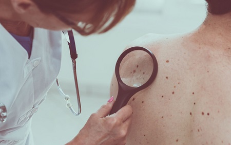 Watching and Waiting: New Data Provides Guidance for Management of Moderately Dysplastic Moles