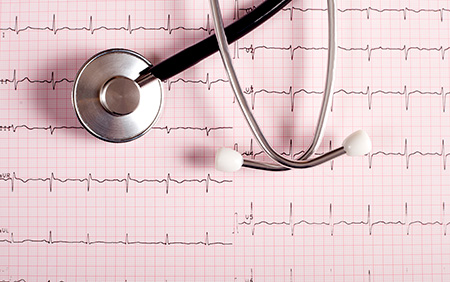 Study Finds Common Complication of Pacemakers Four Times Higher Than Previously Thought