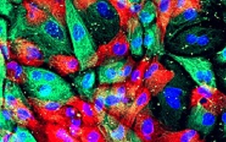 Cancer's gene determined "immune landscape" dictates progression of prostate tumors