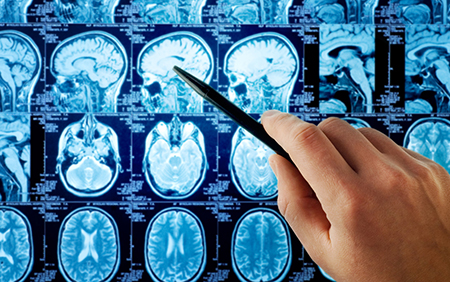 How Sleep Nurtures Your Brain