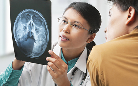Stroke Warning Signs