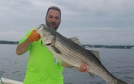 Robotic Surgery Fashions Cancer-Free Bladder