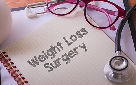 Frequently Asked Questions about Weight Loss Surgery