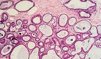 New Way to Enlarge Tissues Gives Pathologists a Closer Look at Cells