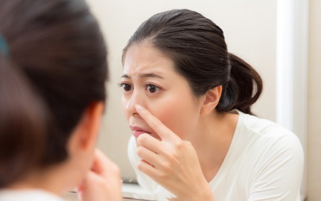 Can-Stress-Cause-Acne