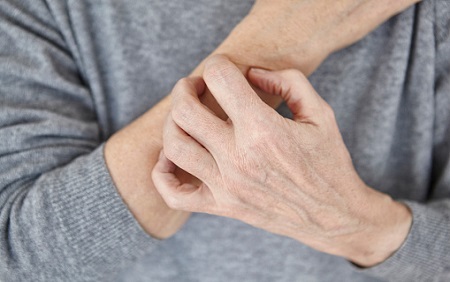 10 Strange Skin Problems that Could Be a Sign of a Serious Disease