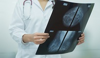 Newly Discovered Vulnerability in an Aggressive Breast Cancer Provides Therapeutic Target