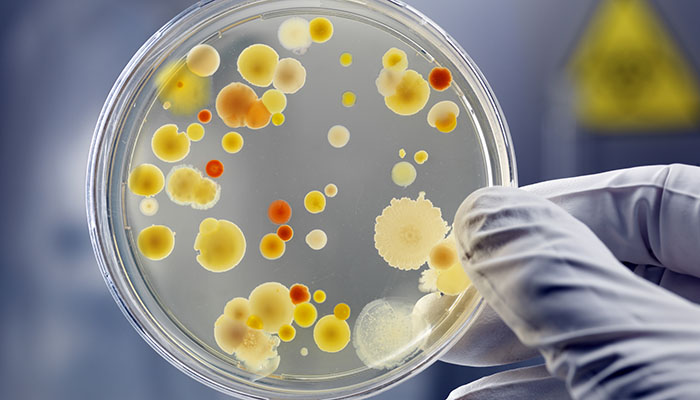 Bacteria Culture in a Petri Dish