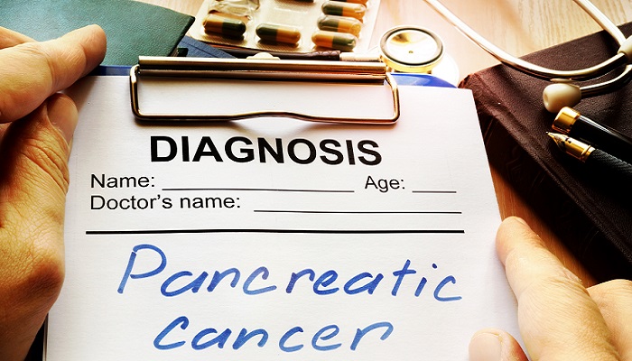 Pancreatic Cancer Diagnosis