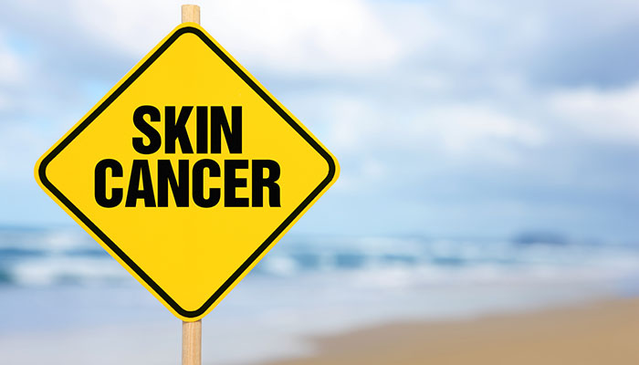 Skin Cancer Yield Sign