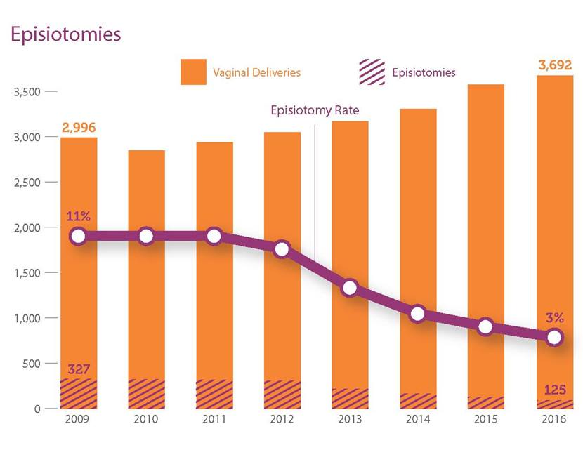 Episiotomy