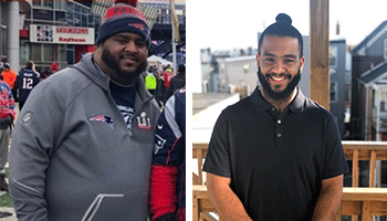 BIDMC Weight Loss Surgery Patient Derron Before and After
