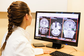 Oncologist examines brain scans.