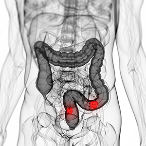 colon and rectum