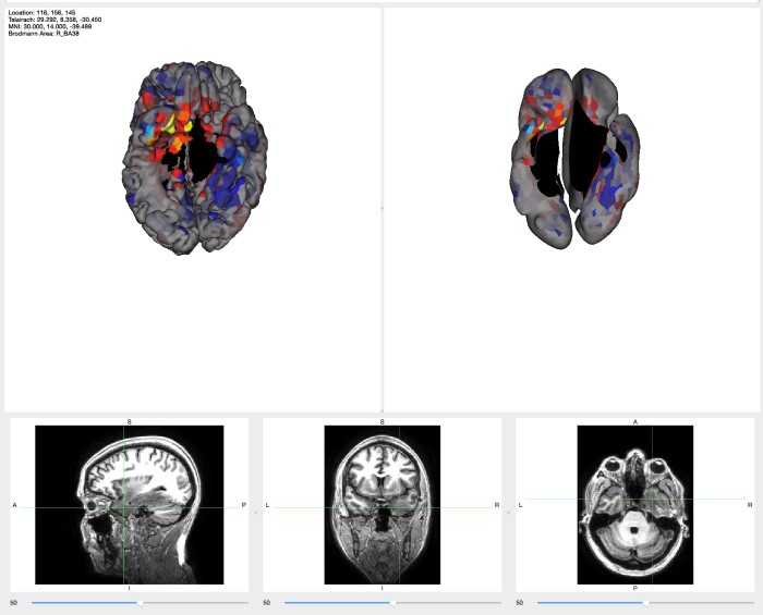 eeg readout