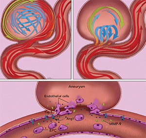 Neurosurgical flow diversion