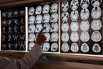 Doctor pointing at MRI of human brain