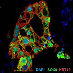OrganoidColorful250