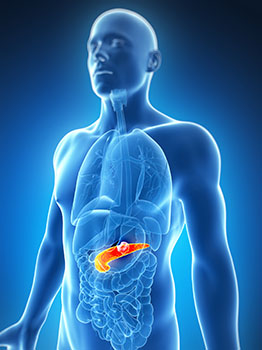 Pancreatic Disease Illustration
