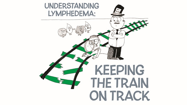 Understanding Lymphedema Slide