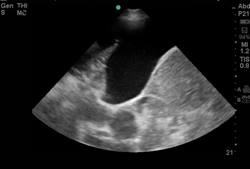 BIDMC Ultrasound