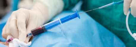 Nephrology fellow inserting a catheter