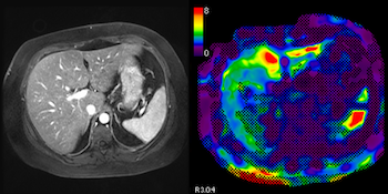 Body MRI