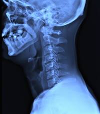 head and neck