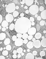 Brown fat from mouse
