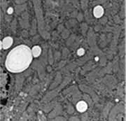liver mitochondria from mouse