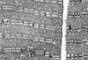 white muscle fiber from mouse