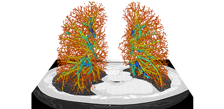 Lungs graphic