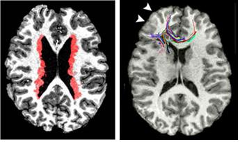 MRI