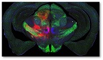 Image Graph of the Circuit modulation to improve movement disorders