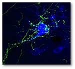 Image of the Channelrhodopsin Assisted Circuit Mapping (CRACM) tool