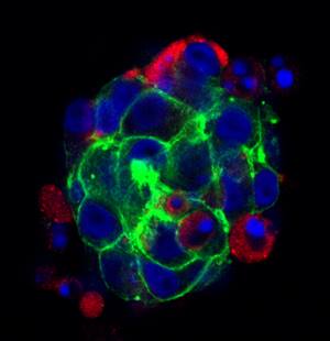 sample6sphere2 for lab page